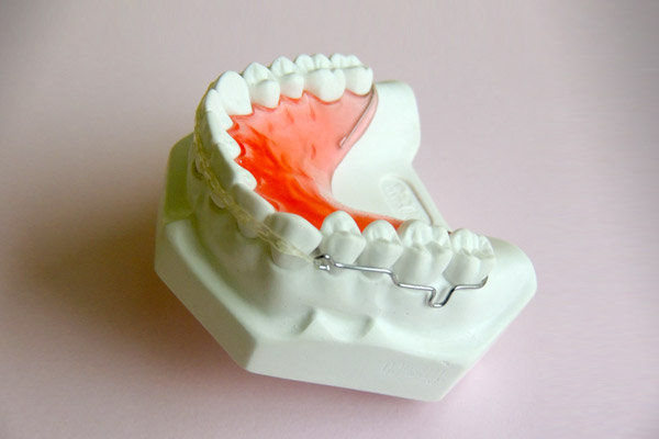 Ortodoncia aparato de retención